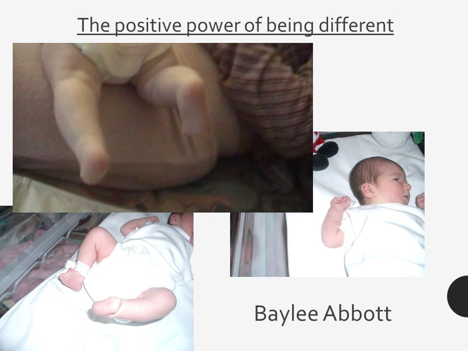 Baylee Abbott